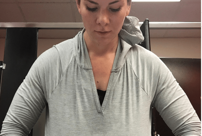 gerrish medesthetics patient after miradry only front of workout shirt shows sweat