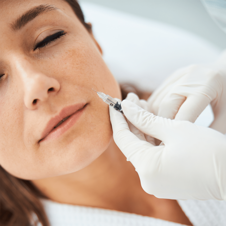 GERRISH_BLOG_galderma_smile_lines